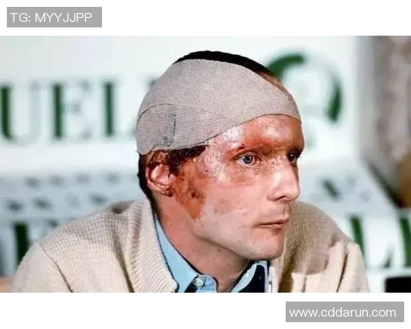 尼基劳达：从赛车传奇到环保先锋的精彩人生旅程